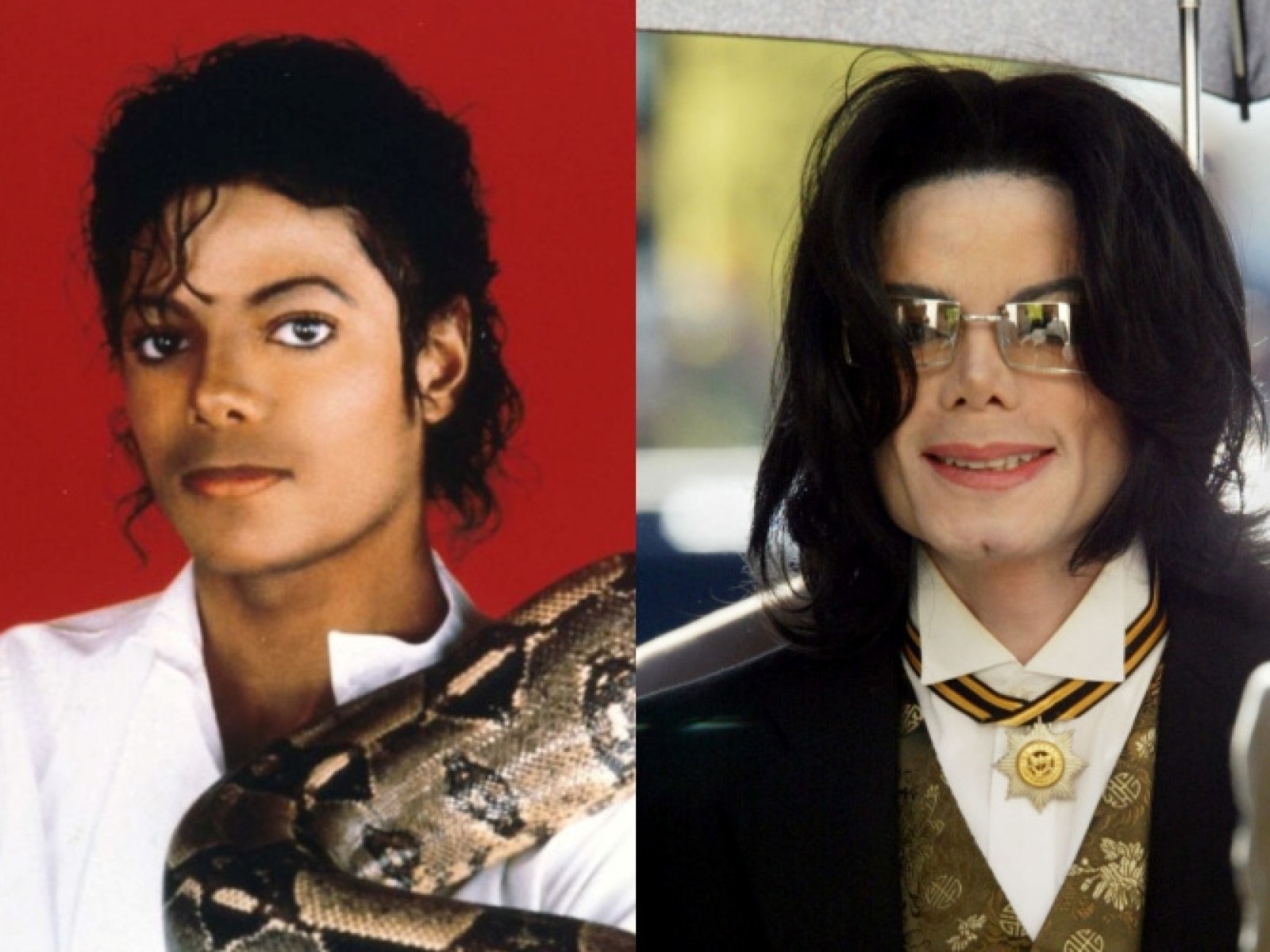 How Did Michael Jackson's Skin Turn White As He Got Older?