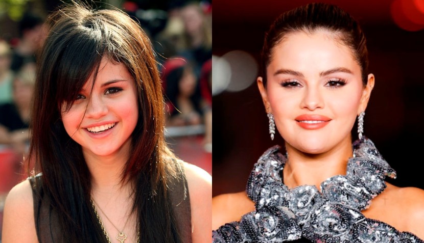 Did Selena Gomez Undergo Plastic Surgery? Singer Reveals Truth